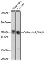 Cathepsin H/K/L/V Antibody in Western Blot (WB)