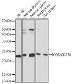 ICOS Antibody in Western Blot (WB)