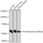 Thromboxane synthase Antibody in Western Blot (WB)
