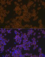 PLCG2 Antibody in Immunocytochemistry (ICC/IF)