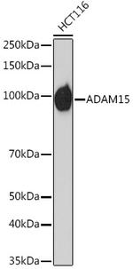 ADAM15 Antibody in Western Blot (WB)