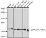 CDKN2C Antibody in Western Blot (WB)