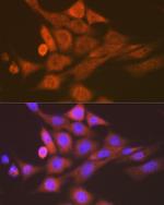 SKP1 Antibody in Immunocytochemistry (ICC/IF)