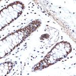 HMGB2 Antibody in Immunohistochemistry (Paraffin) (IHC (P))