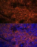 Hemoglobin alpha Antibody in Immunohistochemistry (Paraffin) (IHC (P))