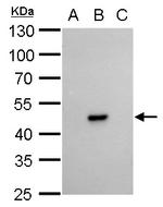 Dengue Virus Type 2 NS1 Antibody in Western Blot (WB)