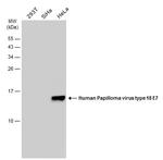 HPV Type 18 E7 Antibody in Western Blot (WB)