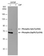 Phospho-Zap-70 (Tyr319, Tyr352) Antibody in Western Blot (WB)