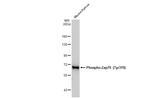 Phospho-Zap-70 (Tyr319, Tyr352) Antibody in Western Blot (WB)