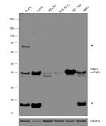 beta Dystroglycan Antibody in Western Blot (WB)