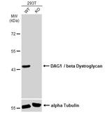 beta Dystroglycan Antibody in Western Blot (WB)