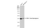 beta Dystroglycan Antibody in Western Blot (WB)