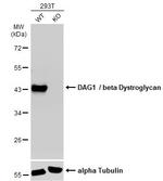 beta Dystroglycan Antibody in Western Blot (WB)