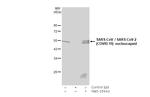 SARS-CoV/SARS-CoV-2 Nucleocapsid Antibody in Immunoprecipitation (IP)