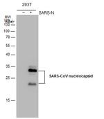SARS-CoV/SARS-CoV-2 Nucleocapsid Antibody in Western Blot (WB)