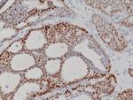 Progesterone Receptor Antibody in Immunohistochemistry (Paraffin) (IHC (P))