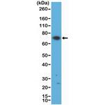 Zap-70 Antibody in Western Blot (WB)