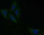 ROBO1 Antibody in Immunocytochemistry (ICC/IF)