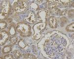 ROBO1 Antibody in Immunohistochemistry (Paraffin) (IHC (P))