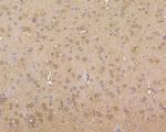 ROBO1 Antibody in Immunohistochemistry (Paraffin) (IHC (P))