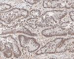 MTA2 Antibody in Immunohistochemistry (Paraffin) (IHC (P))