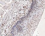 MTA2 Antibody in Immunohistochemistry (Paraffin) (IHC (P))