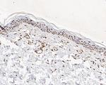 MTA2 Antibody in Immunohistochemistry (Paraffin) (IHC (P))