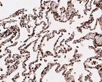 HMGN2 Antibody in Immunohistochemistry (Paraffin) (IHC (P))