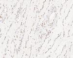 SUPT5H Antibody in Immunohistochemistry (Paraffin) (IHC (P))