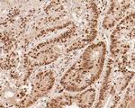 SUPT5H Antibody in Immunohistochemistry (Paraffin) (IHC (P))