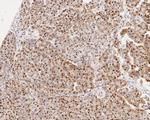 SUPT5H Antibody in Immunohistochemistry (Paraffin) (IHC (P))