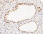 SUPT5H Antibody in Immunohistochemistry (Paraffin) (IHC (P))