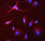 GAA Antibody in Immunocytochemistry (ICC/IF)