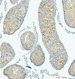 PDCD6IP Antibody in Immunohistochemistry (Paraffin) (IHC (P))