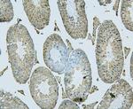 PDCD6IP Antibody in Immunohistochemistry (Paraffin) (IHC (P))