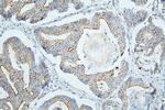 PDCD6IP Antibody in Immunohistochemistry (Paraffin) (IHC (P))