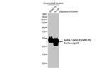 SARS-CoV-2 Nucleocapsid Antibody in Western Blot (WB)