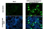 SARS-CoV-2 Nucleocapsid Antibody in Immunocytochemistry (ICC/IF)