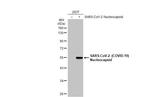 SARS-CoV-2 Nucleocapsid Antibody in Western Blot (WB)