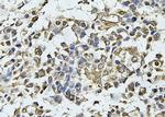 Claudin 6 Antibody in Immunohistochemistry (Paraffin) (IHC (P))