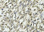 Claudin 6 Antibody in Immunohistochemistry (Paraffin) (IHC (P))