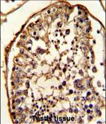 beta Tubulin Antibody in Immunohistochemistry (Paraffin) (IHC (P))