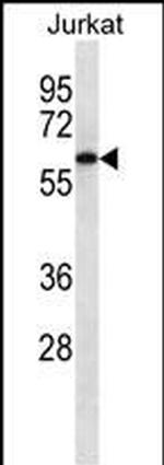 CAMKK2 Antibody in Western Blot (WB)