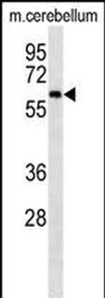 CAMKK2 Antibody in Western Blot (WB)