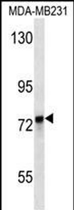 KEAP1 Antibody in Western Blot (WB)