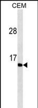 Gastrin Antibody in Western Blot (WB)