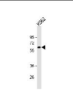 Catalase Antibody in Western Blot (WB)