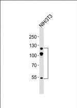 Abl2 Antibody in Western Blot (WB)