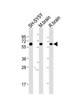 CRMP5 Antibody in Western Blot (WB)