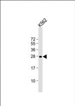 RAB27A Antibody in Western Blot (WB)